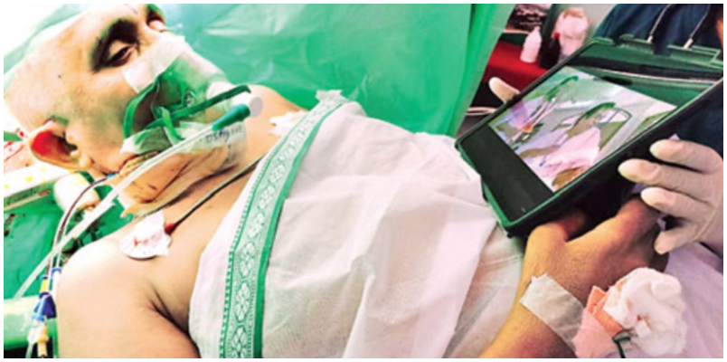 Patient watches Jr NTR film as doctors perform brain surgery