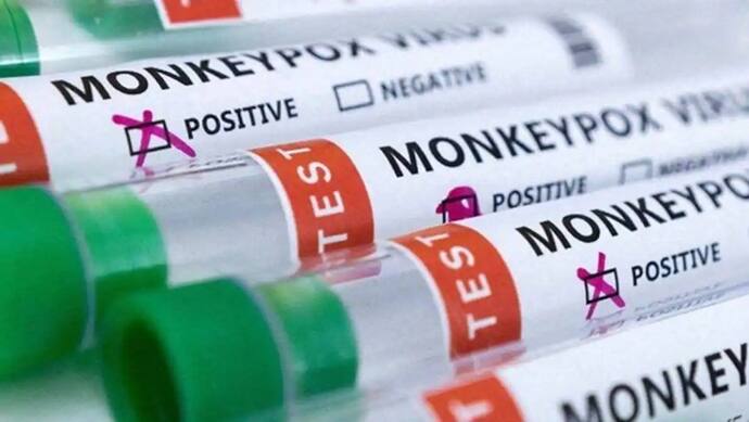 Kerala to issue revised Mpox guidelines following first confirmed case of new strain