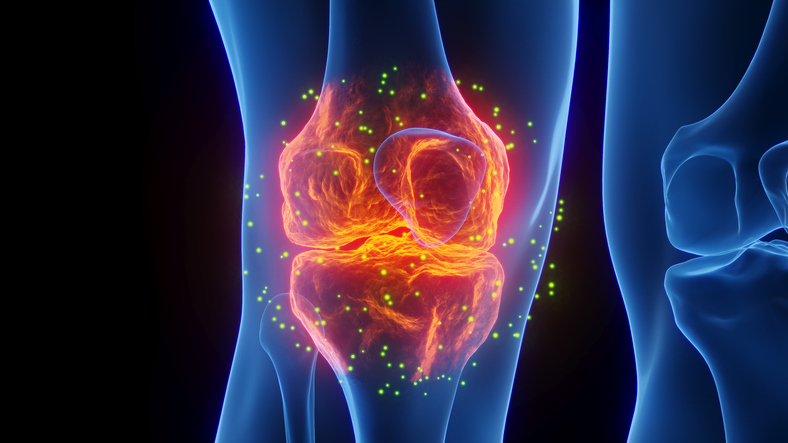 arthritis pain