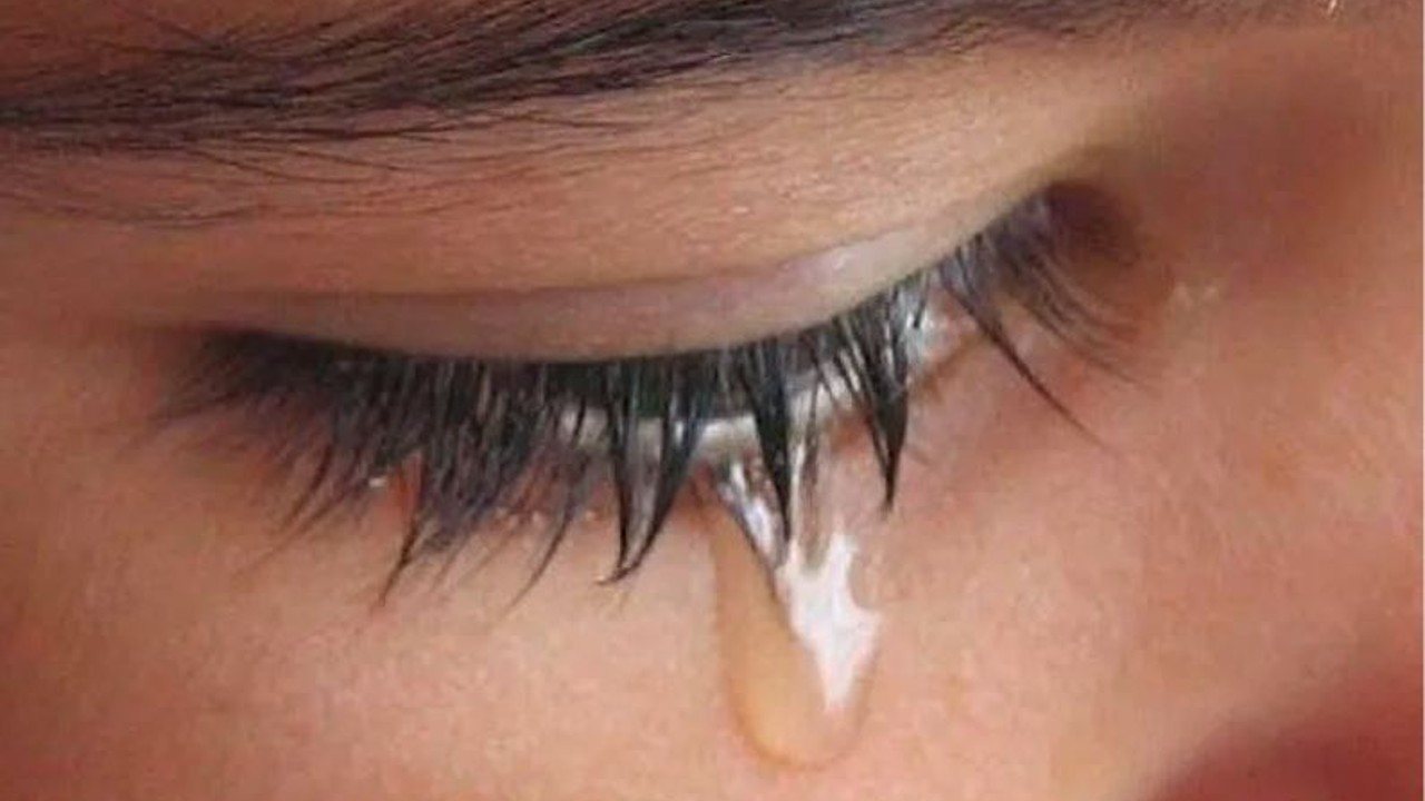 The Science Behind Final Tears Why do tears come in a persons eyes before dying