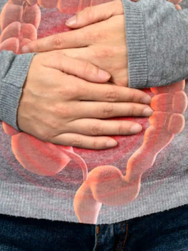 Irritable Bowel Syndrome: Symptoms, causes, and treatment dmn