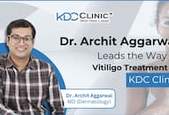 Dr. Archit Aggarwal Leads the Way in Vitiligo Treatment at KDC Clinic