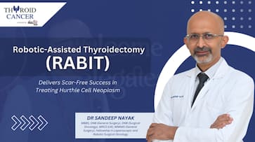 Robotic-Assisted Thyroidectomy (RABIT) Delivers Scar-Free Success in Treating Hurthle Cell Neoplasm