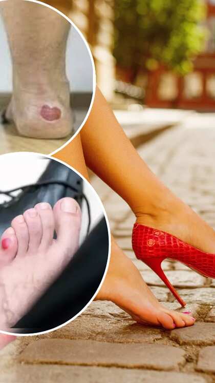 Use petroleum jelly
