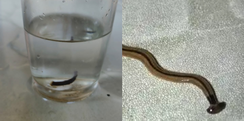 Hammerhead Worm found from drinking water in alappuzha