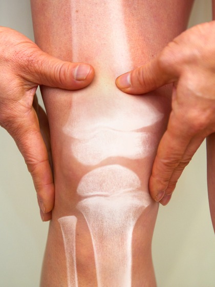 क्या Arthritis सिर्फ बुजुर्गों की बीमारी? बच्चों को हो सकती है या नहीं