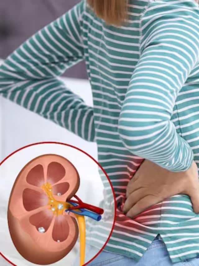 Daily Habits That Can Silently Damage Your Kidneys in tamil mks