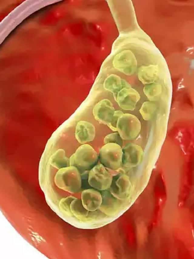 if-you-eat-these-foods-danger for gallbladder