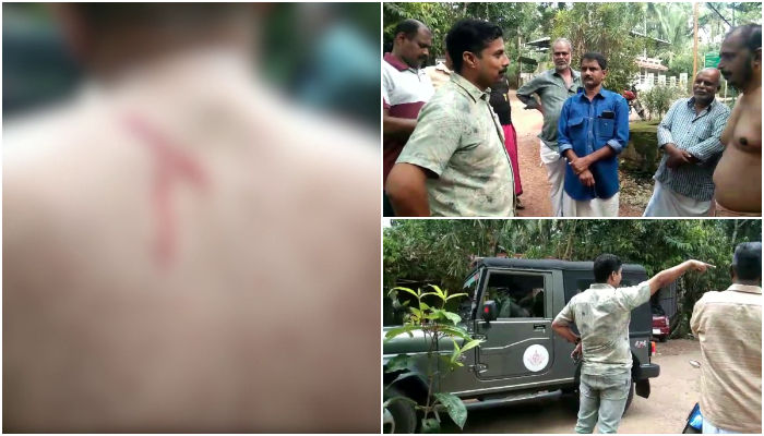 mountain squirrel attack young man injured in chozhiyakkod kollam 