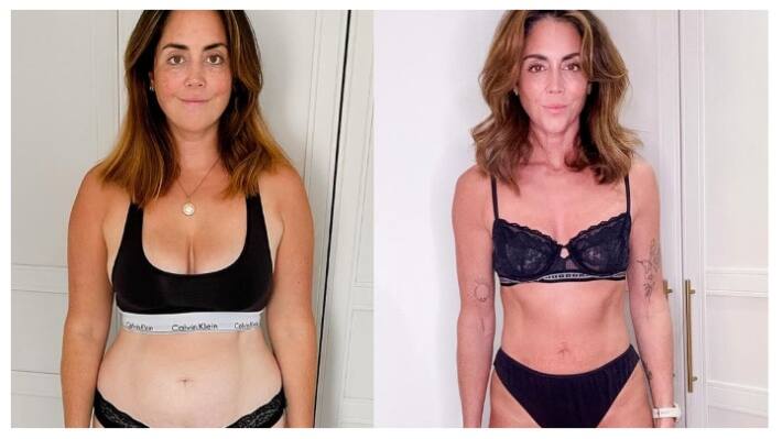 Weight loss 