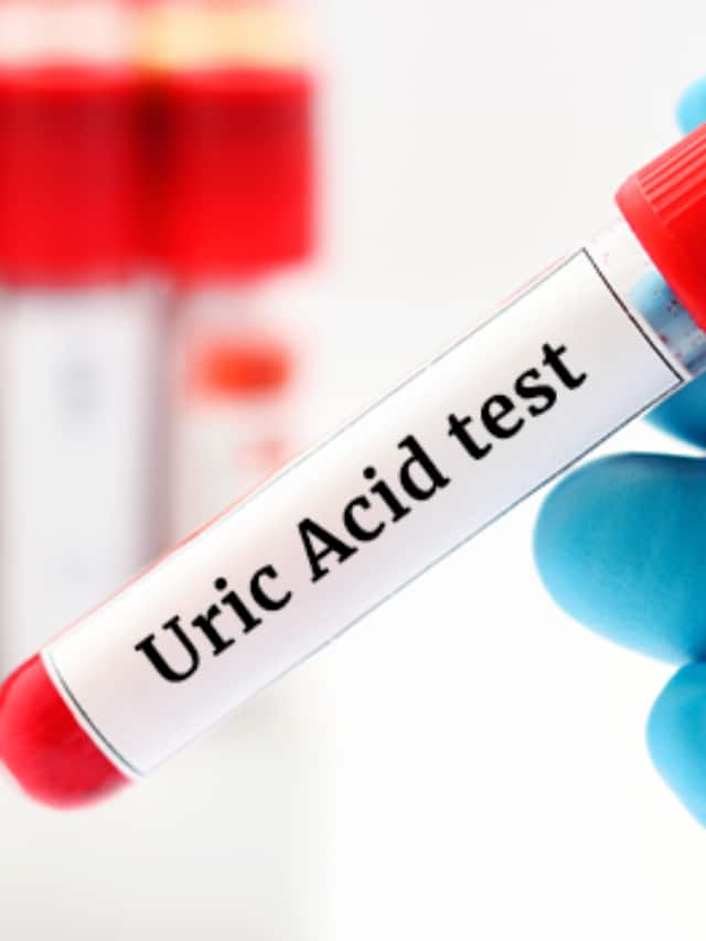 foods to avoid if you have high uric acid levels 