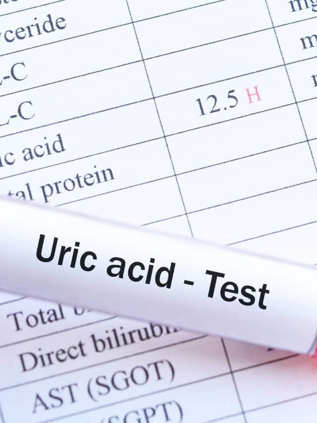 six drinks that help to control uric acid levels