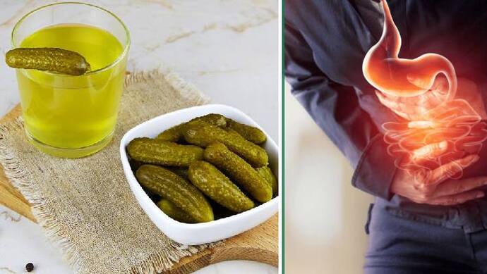  pickle juice benefits in acid reflux 