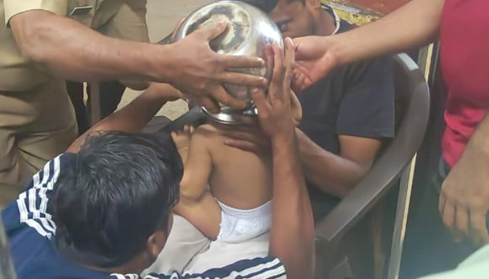 One and a half year old girl got a steel pot stuck on her head Rescued by the fire force at kozhikode