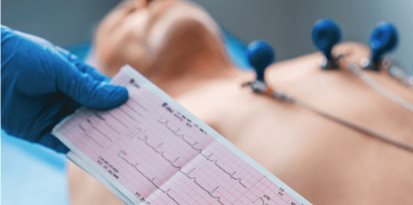 lab attendant performing an ECG scan on a patient after  watching YouTube clip at Rajasthan Jodhpur