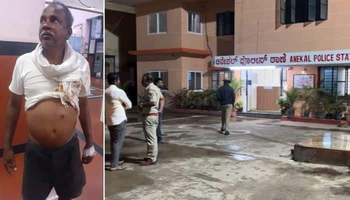 Bengaluru Man injured after being shot with double barrel gun during scuffle Police launch manhunt vkp