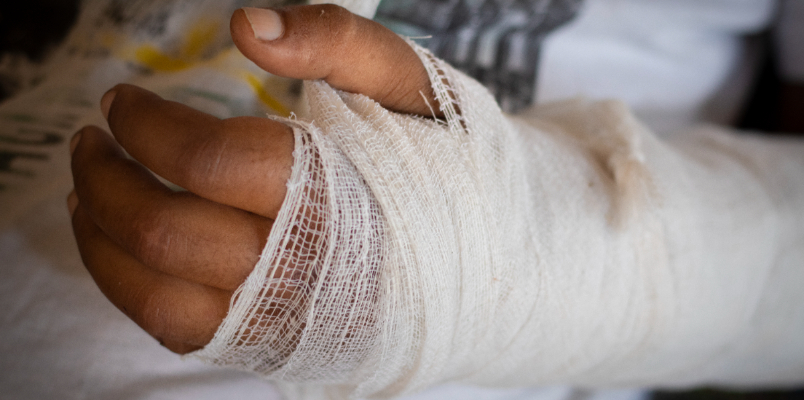 arm fracture treated with plaster but hand bent consumer court order against doctor and hospital