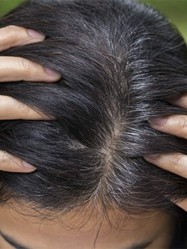 this vitamin deficiency leads to premature grey hair