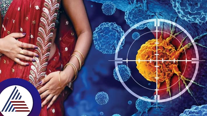 What is petticoat or saree cancer Researchers recommend loosening up a bit to avoid this issue suc