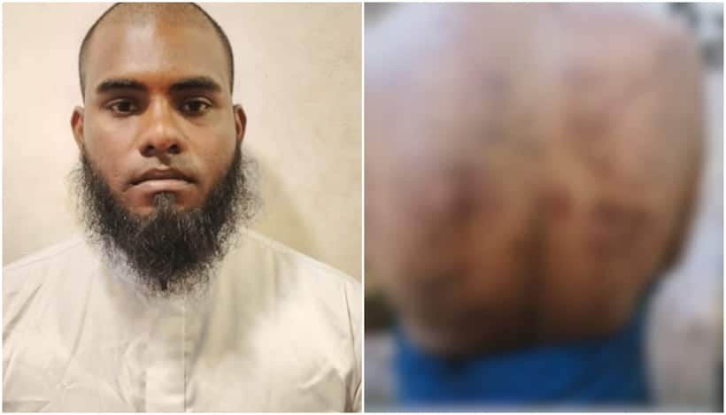 Madrasa teacher held in Kerala's Kannur for burning student, applying chilli powder on private parts