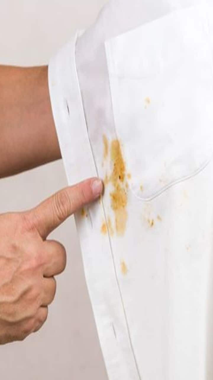 tips and tricks to remove turmeric and tea stains from your white clothes in tamil mks