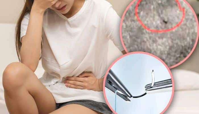 After 18 Years Of Pain From Childbirth Woman Finds Needle Left Inside Her vagina san