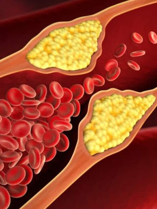 These are the 9 fruits that reduce bad cholesterol tvk