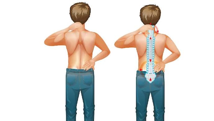 how to cure back pain with acupressure