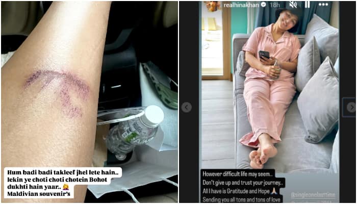 Hina Khan shares health update amid Maldives vacation; sustains leg injury [PHOTOS] ATG