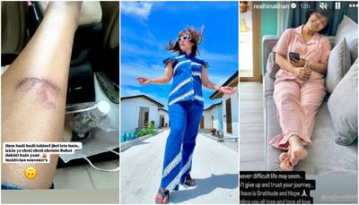 Hina Khan shares health update amid Maldives vacation; sustains leg injury [PHOTOS]