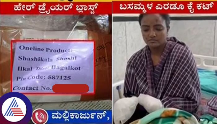 Bagalkot hair dryer explosion deceased soldier wife Basamma lost both hands sat