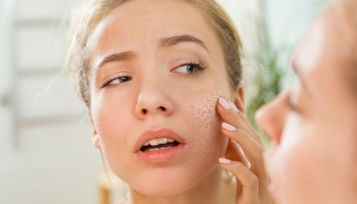 tips and home remedies to get rid of Dry Skin in winter