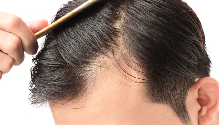 reasons for hair loss in very young age ans