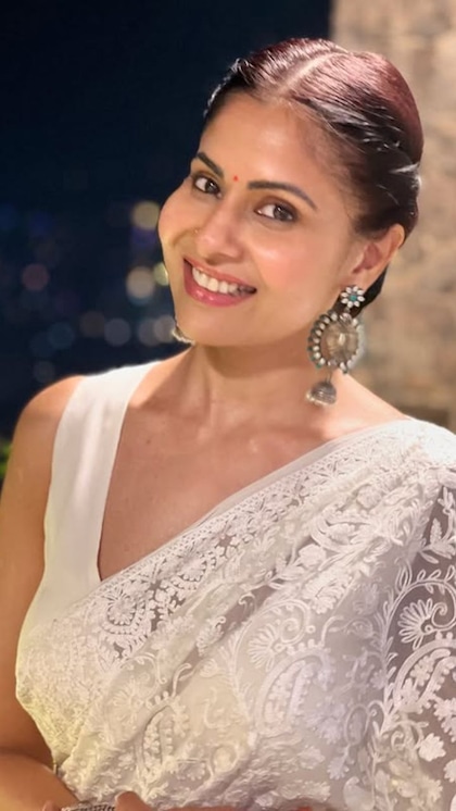 Chhavi Mittal - Lupus Rash