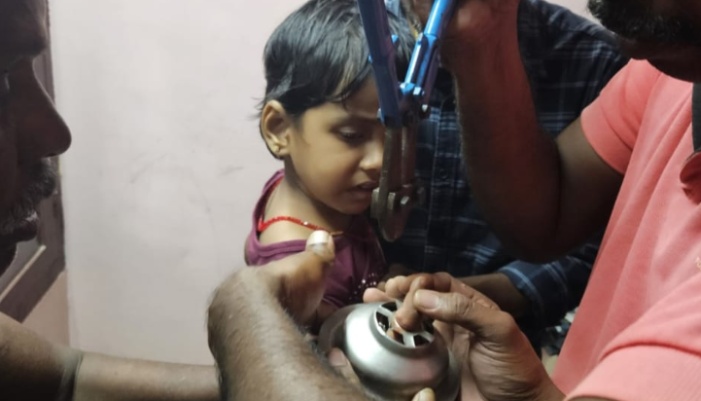 four year-old girls hand stuck in the sink fire and rescue team rescued in thrissur