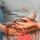 Prevent Colon Cancer Naturally