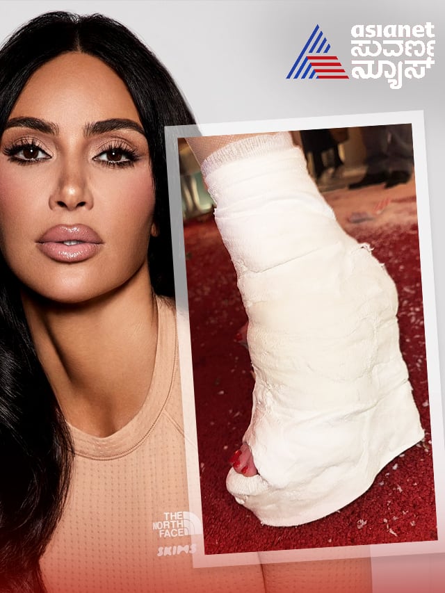 kim kardashian turns foot injury in to fashion recent post goes viral ckm