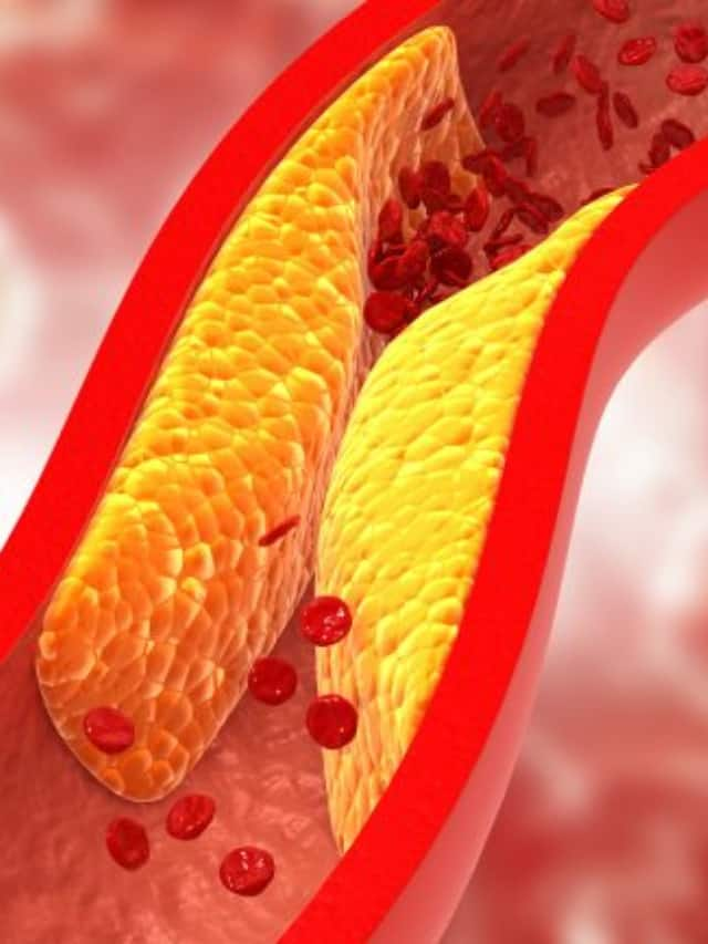 natural ways to control cholesterol level