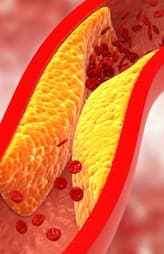 tips to lower cholesterol levels 
