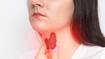 Iodine deficiency: Symptoms in the body mma