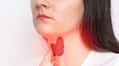 Iodine deficiency: Symptoms in the body mma