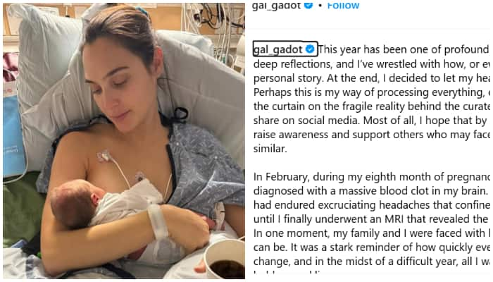 Gal Gadot Reveals Recovery after Life-Threatening Pregnancy Complications-rag