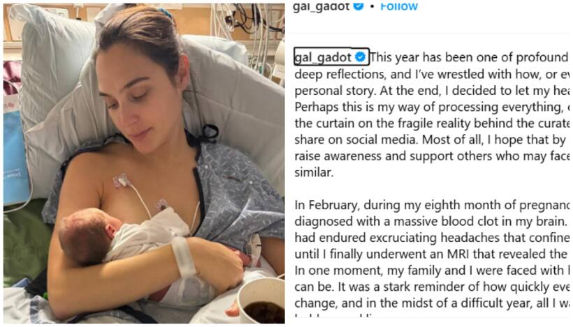 Gal Gadot OPENS up about life threatening pregnancy complications, recovery; Read on
