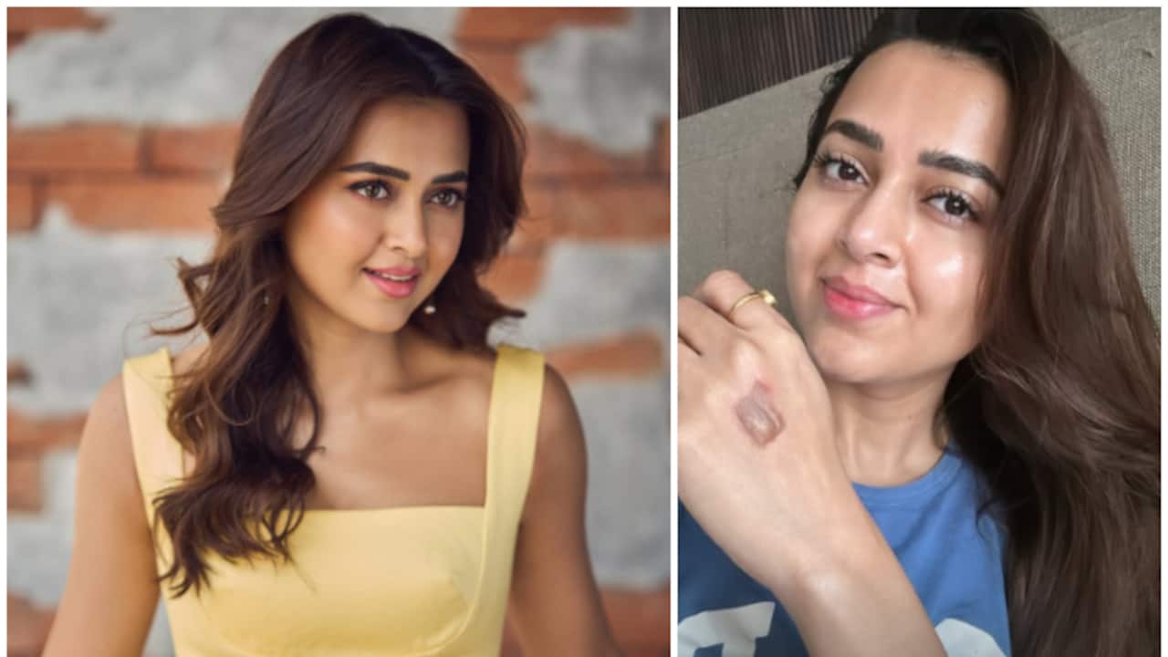 Tejasswi Prakash shares photo of burn injury from celebrity MasterChef, says 'The show must go on'