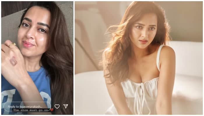 Tejasswi Prakash shares photo of burn injury from celebrity MasterChef, says 'The show must go on' NTI