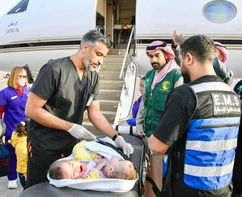 ten months old conjoined twins reached riyadh for separation surgery 