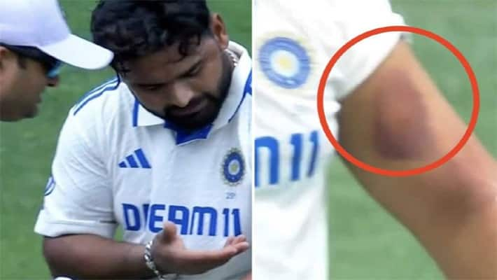 Rishabh Pant Injured during India vs Australia in Sydney Test Match rsk