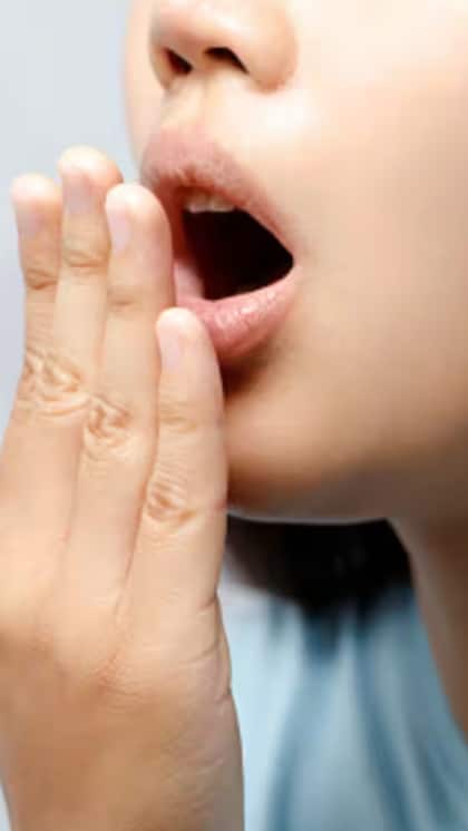 నోటి దుర్వాసన