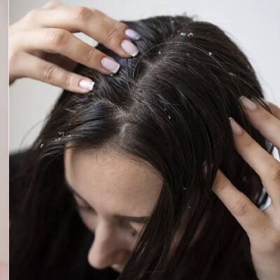 Hair Growth: పెరుగులో ఇదొక్కటి కలిపి రాస్తే...జుట్టు పట్టుకుచ్చులా మెరుస్తుంది..!