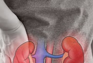 kidney-problems-warning-signs-symptoms-and-care